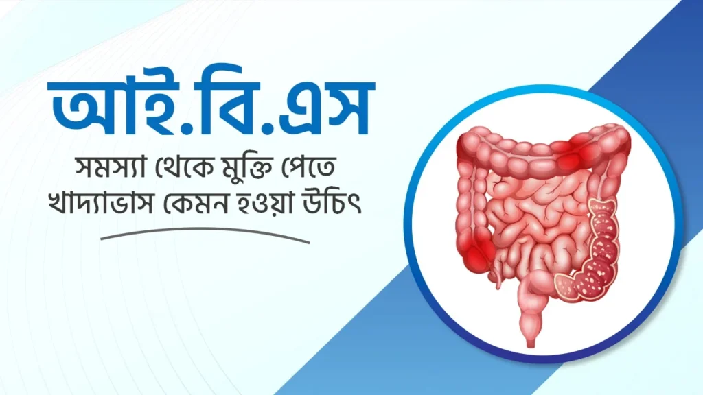 আইবিএস (IBS) সমস্যা থেকে প্রাকৃতিক উপায়ে মুক্তির উপায়