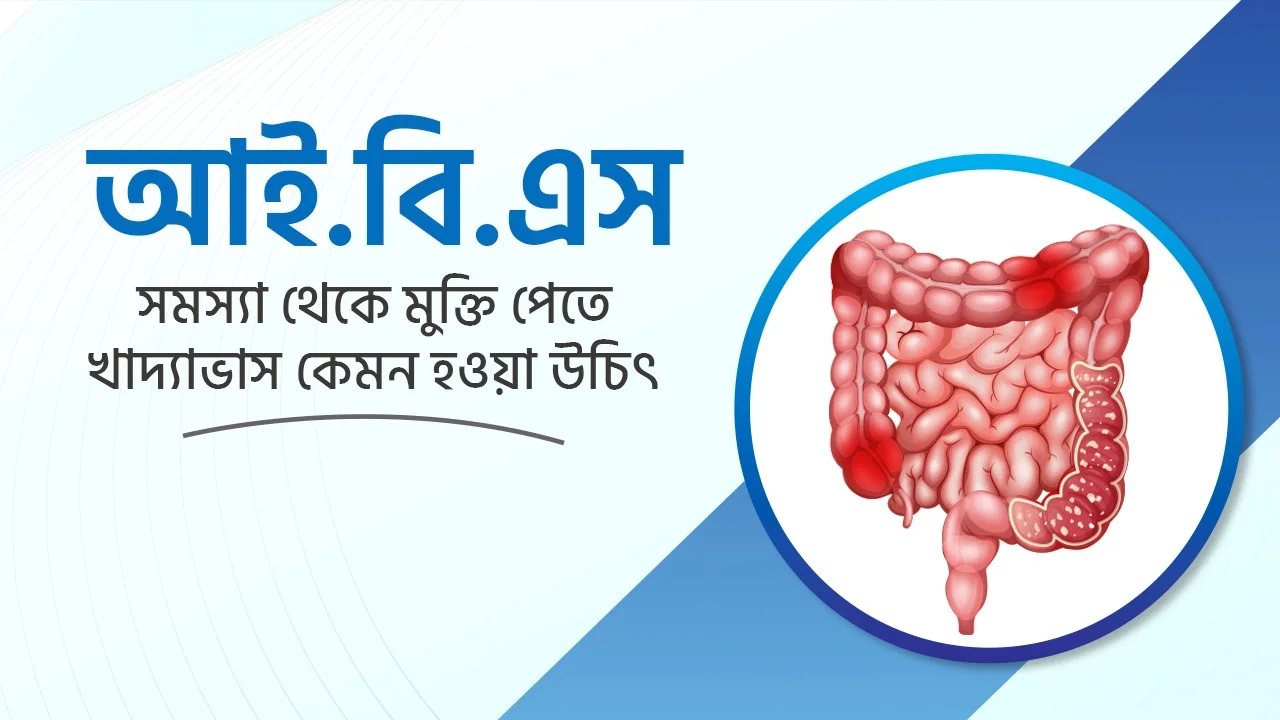 আইবিএস (IBS) সমস্যা থেকে প্রাকৃতিক উপায়ে মুক্তির উপায়