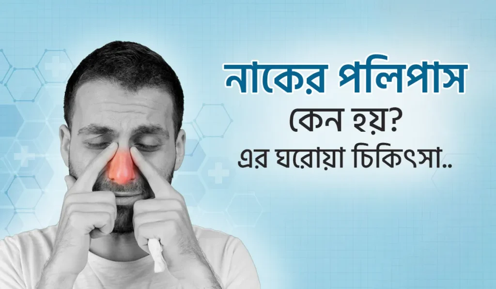 নাকের পলিপাস হওয়ার কারণ ও পলিপাসের ঘরোয়া চিকিৎসা