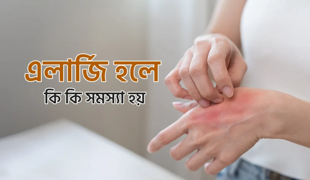 এলার্জি হলে কি সমস্যা হয়