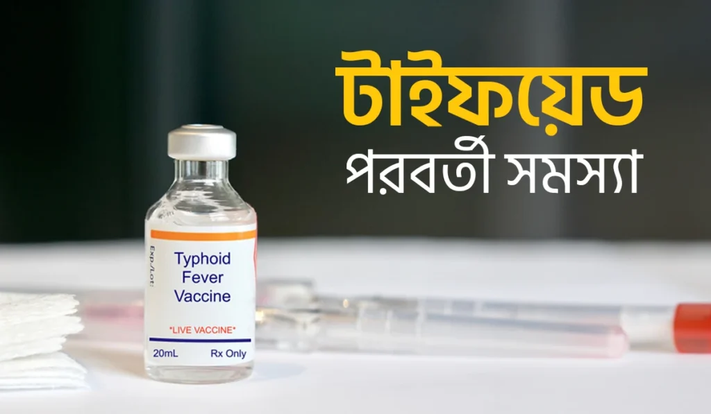 টাইফয়েড পরবর্তী সমস্যা, জেনে নিন প্রতিরোধের উপায়