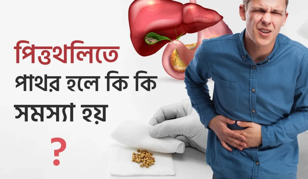 পিত্তথলিতে পাথর হলে কি কি সমস্যা হয়