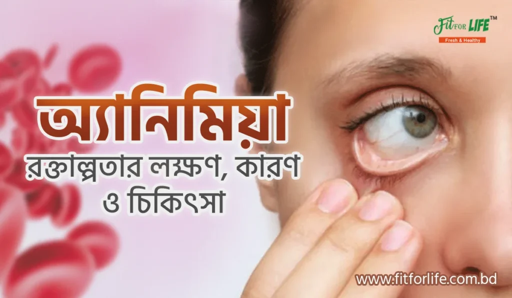 অ্যানিমিয়া বা রক্তশূন্যতা
